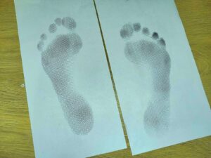 Wady stóp u seniorów – częsty problem, którego nie warto lekceważyć
Wraz z wiek